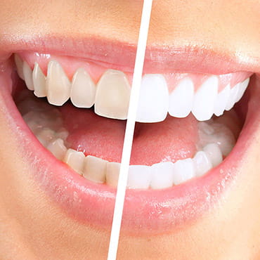 dentaria clinic whitening background image